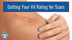 VA Disability for Scars
