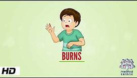 Burns, Causes, Signs and Symptoms, Diagnosis and Treatment.