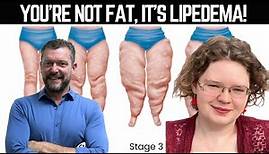 It's NOT Obesity, it's Lipedema [with Siobhan Huggins]