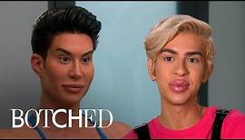 Real Life "Barbie" & "Ken" Fix Botched Surgeries | Botched | E!