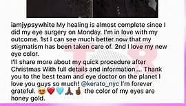 Model Jessica White DRAGGED For Getting Surgery To Change Eye Color Same As Tiny #LHHATL
