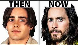 Jared Leto Mystery: Plastic Surgeon's Analysis of His Unchanging Face