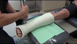 Removing and Bivalving a Cast