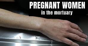 Pregnant women in the mortuary