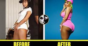 Nicki Minaj Plastic Surgery Before and After ( Boob Job | Fake Butt Implants ) - Plastic Surgery TV