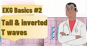 T wave abnormalities | Tall t wave and t wave inversion | causes, ECG findings and examples