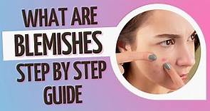 What are Blemishes? Step by Step Guide