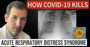 How Coronavirus Kills: Acute Respiratory Distress Syndrome (ARDS) & COVID 19 Treatment
