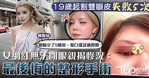 【整容失敗】19歲起割雙眼皮失敗5次　女網紅無法閉眼親揭慘況：超後悔 - 香港經濟日報 - TOPick - 健康 - 健康資訊