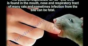 Rat Bite Fever - Everything You Need To Know - Dr. Nabil Ebraheim
