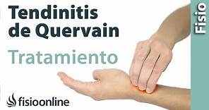 Tendinitis de De Quervain - Tratamiento con ejercicios, automasajes y estiramientos