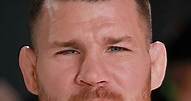 What happened to Michael Bisping's eye?