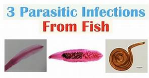 3 Parasitic Infections From Fish (Diphyllobothriasis, Clonorchiasis, Anisakiasis)