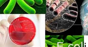 How To Treat E.Coli Sickness At Home | Symptoms &Causes 2020