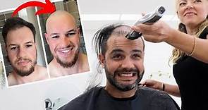 BALDING MEN Go BALD For The FIRST TIME *Compilation*