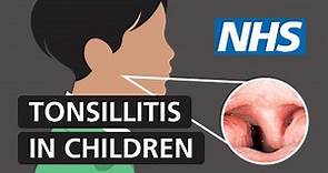 Tonsillitis in children: Symptoms and treatment | NHS