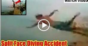 split face diving accident - diving face split -face split diving accident video - split face diving