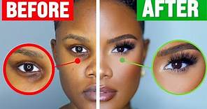How To COVER Dark Under Eye Circles