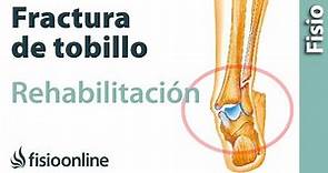 Rehabilitación de fracturas de tobillo con ejercicios, automasajes y estiramientos
