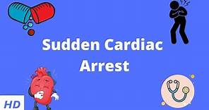 Sudden Cardiac Arrest, Causes, Signs and Symptoms, Diagnosis and Diagnosis.