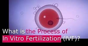 IVF PROCESS: HELPFUL STEP BY STEP GUIDE (In Vitro Fertilization)