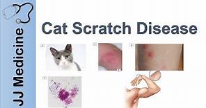 Cat Scratch Disease | Causes, Symptoms and Treatment