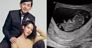 恭喜！孟耿如宣布懷孕了 曬超音波照：寶寶已在肚裡3個月｜東森新聞