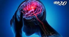 感染Delta病毒小心「新冠頭痛」！醫提醒：出現這種頭痛要警覺｜健康2.0