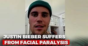 Watch: Justin Bieber Tells Fans He Is Suffering From Facial Paralysis