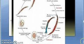 Parasitology 200 b Hookworm,ancylostoma duodenale,life cycle,egg,adult,rhabdiform,filariform larva