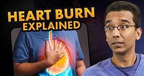 Say Goodbye to Heartburn: The Complete Guide to FIX Heartburn (GERD) & Acid Reflux