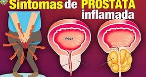 Estos Son Los Síntomas de la Próstata Inflamada y Nunca Debes Ignorarlos !CUIDADO!
