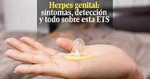 Herpes genital: síntomas, detección, tratamiento y todo lo debes saber sobre esta enfermedad