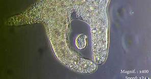 Amoeba eats paramecia ( Amoeba's lunch ) [ Amoeba Endocytosis / Phagocytosis Part 1 ] 👌