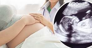 【產前檢查】T21跟唐氏綜合症篩查OSCAR大不同？　新手媽媽必讀產檢時間表 - 香港經濟日報 - TOPick - 親子 - 兒童健康