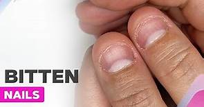 Extremely Bitten Nails Transformation | How to Repair Damaged Nails?