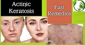 Actinic keratosis: Causes and Natural Treatments
