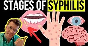 Doctor explains the Symptoms and Stages of SYPHILIS (STI)