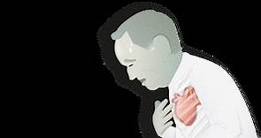 Insuficiencia Cardíaca | Causas, Síntomas, Tratamiento | PortalCLÍNIC