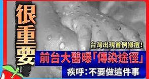 台灣出現首例猴痘！ 前台大醫曝「傳染途徑」疾呼：不要做這件事 | 台灣新聞 Taiwan 蘋果新聞網