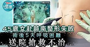 【整容意外】45歲女赴越南整形失敗　術後5天呼吸困難送院搶救不治 - 香港經濟日報 - TOPick - 健康 - 保健美顏