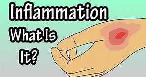 Inflammation - Inflammatory Response - What Is Inflammation In The Body?