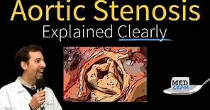 Aortic Stenosis Explained Clearly - Diagnosis and Treatment