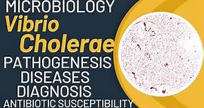 Vibrio cholerae cholera | Vibrio cholerae microbiology | Pathogenesis, lab diagnosis