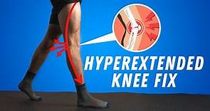 CORRECT Your Hyperextended Knees Fast (NO EQUIPMENT NEEDED)