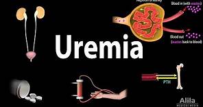 Uremia: Pathophysiology, Symptoms, Diagnosis and Treatment, Animation