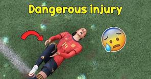 Alexia Putellas's dangerous injury | Fifa 2022