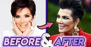 Kris Jenner | Before and After Transformations | Plastic Surgery Rumours