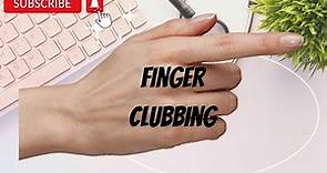 Finger Clubbing -Definition, Pathophysiology, Causes ( mnemonic)and Staging.
