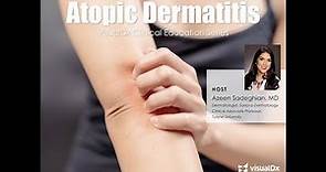 Atopic Dermatitis: VisualDx Clinical Education Series